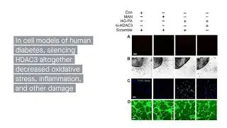 HDAC3: A new target in treating diabetic vasculopathy