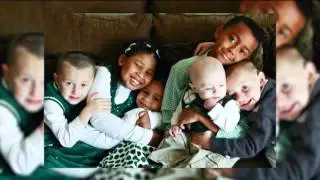Heart Transplant patient gets Bariatric Surgery &ndash; Jon Schram, MD, FACS