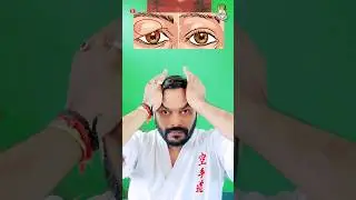 karate | Exercises to reduce fat above the eyes | Martial Arts With Kuldeep