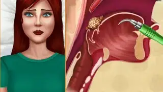 ASMR heart surgery❤️ changes in teeth when treated _tooth brace.[satisfied dentel treatment]