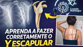 RADIOGRÁFIA DE PERFIL Y ESCAPULAR E MÉTODO DE NEER 