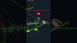 Ethereum DROP But INSANE 11% PUMP Incoming? | ETH Price Prediction