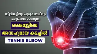 കൈമുട്ട് വേദന | Tennis Elbow Malayalam | Kaimuttu vedana Malayalam | Focuz Ayurcentre