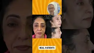 Neogen Plasma for Latino & Ethnic Skin Types | Dr. Arkam Rehman &ndash; Sunshine Spine & Wellness