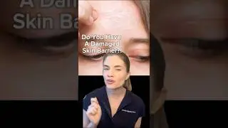 Overloading skincare can strip your barrier, causing redness, dryness, and irritation&mdash;less is more!