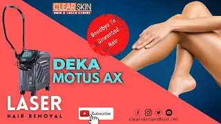 DEKA MOTUS AX-  (New Alexandrite Laser) #laserhairremoval First Time in South India || #clearskin