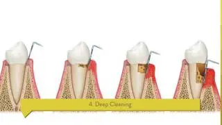 Weston Dental Care for You and Your Family