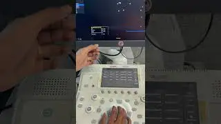 Esaote mylabX7 ultrasound colour Doppler | Basic demonstration #learning #biomedical #hospital