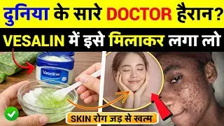 60 की उम्र के बाद वैसलीन ऐसे लगाइए ⚠️गलत तरीका स्किन को और खराब कर देता है ❌ #SkinCareAfter50
