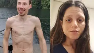 Vegans: The Epitome of Malnourishment 7