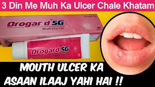 Orogard 5G Gel Kaise Use Kare | Mouth Ulcer, Dard Aur Jalan Ka Instant Ilaaj | 3 Din Me Relief!