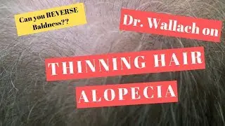 Dr. Wallach on Thinning Hair / Alopecia