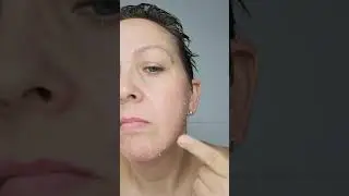 Vitamin c liquid peel