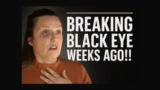 EXPLOSIVE! MUST WATCH! Rebecca Haro&rsquo;s Mother Funeral Aug 5th &ndash; BLK EYE & NO EMMANUAL!