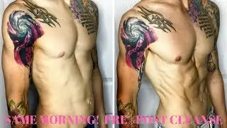 Salt Flush Coffee Enema Cleanse For Naturally Healing Acne, Cystic Acne Breakouts, And Acne Scars