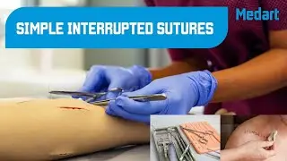 Simple interrupted sutures - simple suturing techniques