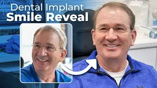 INCREDIBLE Smile Transformation &ndash; Bill&rsquo;s Dental Implant Journey