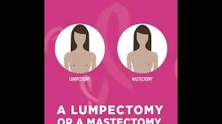 Lumpectomy vs. Mastectomy - Moffitt Cancer Center
