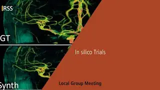 In silico trials