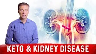 Keto Diet & Kidney Disease &ndash; Dr. Berg