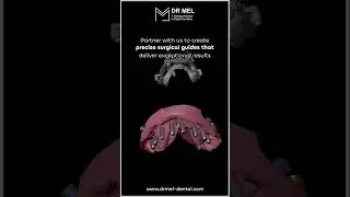 Precise surgical guides that ensure exceptional results | Dr. Mel