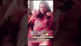 Weight Loss Journey #youtube #viral #youtubeshorts #skincare #pakistan #beauty #love #fatlosstips