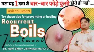 Boils on body home treatment | boils treatment at home | recurrent boils | boils on buttock