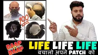 What is the life of different patches | Hair Wig Price, Quality & Life Explained in Hindi