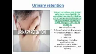 Easy way to solve your Urinary retention