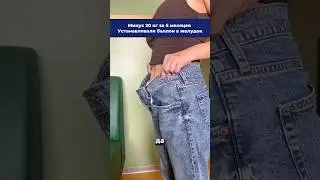 Минус 20 кг за 6 месяцев. Устанавливали баллон в желудок ✅ #похудение #здоровье #бариатрия