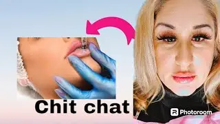 #lunchchat Lunch chit chat | Hyaluronic pen lip filler