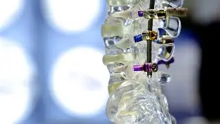 Medical manufacturing of spinal instruments and implants