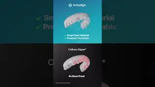 Invisalign | 5 Test Check - Material