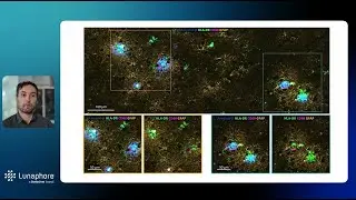 High-resolution spatial mapping of Alzheimer&rsquo;s Disease with COMET&trade;