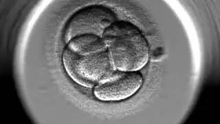 VF Gynem Clinic - D&eacute;veloppement d'embryons EmbryoScope