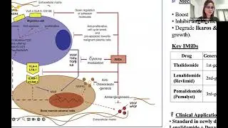Plasma cell neoplasm