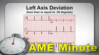 AME Minute: Identification of ECG Normal Variants Reduces Delays - Part 5
