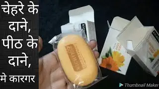 BEST CALENDULA SOAP for ACNE || honest review by be alert product reviews