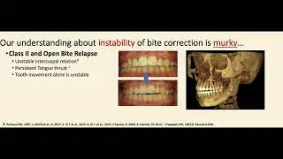 Dr. Drew McDonald, DDS MSPresented at the 2023 AES Scientific Meeting