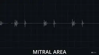 Chill Heartbeat with Breathing ❤️🫁🩺 [Male Heartbeat]