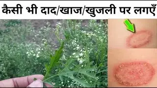 Medicinal properties of carrot grass/know the medicinal uses of carrot grass, medicinal treatment of carrot grass weed for ringworm/scabies/itching