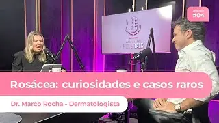EP #4 - #ROSÁCEA: CURIOSIDADES E CASOS RAROS - DR. MARCO ROCHA (DERMATOLOGISTA)