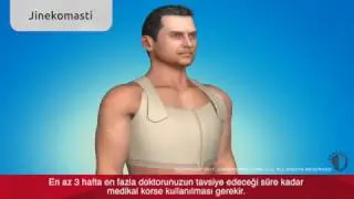 Jinekomasti (Erkekte Meme Küçültme) Ameliyatı Videosu Bursa