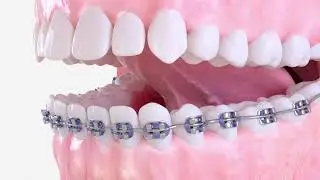 3D-Produktfilm - Dental Demoreel (designidentity bis 2021)