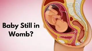When Labor Doesn't Start: Post-Term Pregnancy Guide!