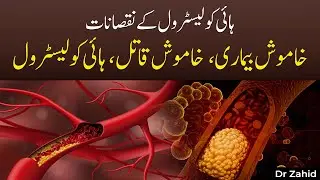 High Cholesterol Se Dil Ko Khatra | Asal Wajuhat Aur Ilaj