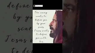 His Scars define you 🔥 #shorts #christianshorts #jesus #christ #ytshorts #god #jesusquotes #psalms