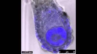 Confocal microscopy of Marchantia polymorpha gametes