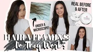 DO HAIR VITAMINS REALLY WORK? Actual 60-day REAL Results