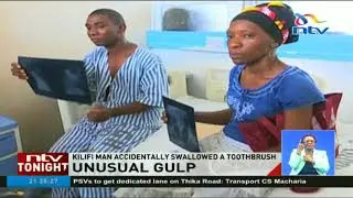 34 year old man needs surgery to remove toothbrush from his stomach